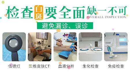 皮肤病白斑专治医院